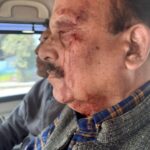 देहरादून में निदेशक अजय कुमार नौडियाल पर हमला, उमेश कुमार काऊ पर आरोप। Uttarakhand 24×7 Live news